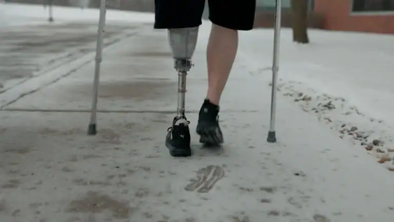 Close-up of a person with a prosthetic leg walking on a sidewalk with crutches, showing a footprint in the snow.